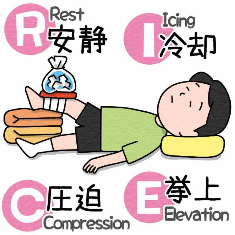 RICE 処置(応急処置)のイメージ画像です。
Rest（安静）、Ice（冷却）Compression（圧迫）、Elevation（挙上）を意味しています。