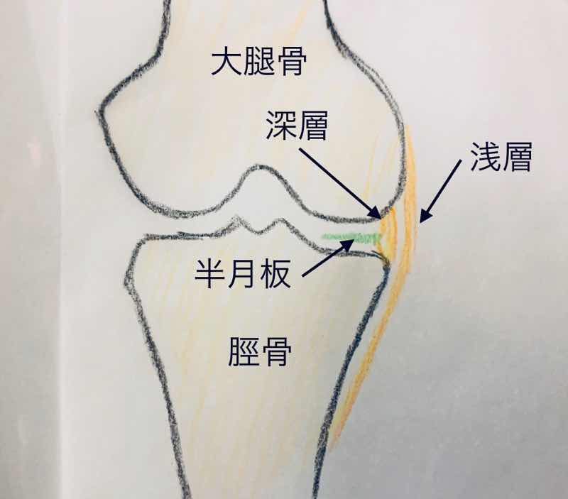 膝関節の内側側副靭帯のイラストです。
内側側副靭帯の浅層、深層、半月板の位置関係がわかります。