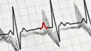 スケッチ風の心電図波形画像。P波部分のみ赤色で、他の波形は黒色。P波は画像中央やや左寄りにあり、周囲に緑丸で示されていた部分が赤色で強調されている。ラベルや補助線は無いシンプルな構成。